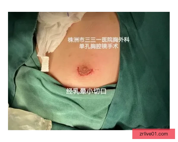 坎宁安气胸康复持续推进 活塞计划一周后复查评估